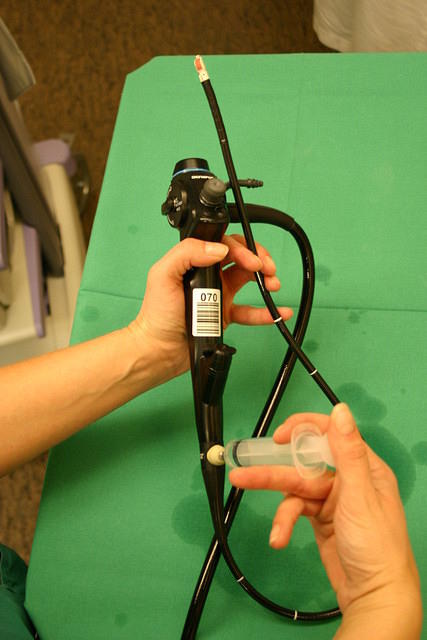 Echo bronchoscope