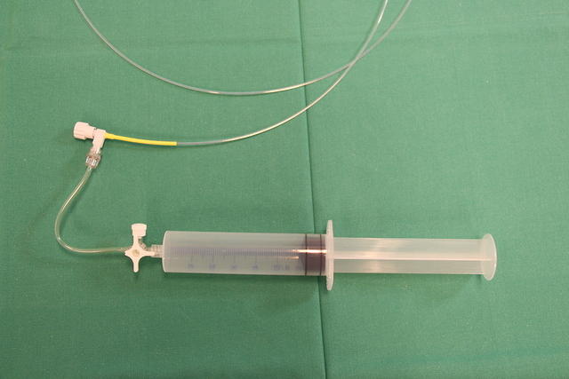 Transbronchial needle (WANG)
