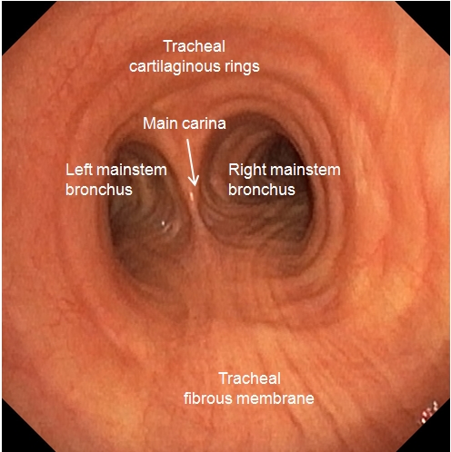 Trachea - annotations