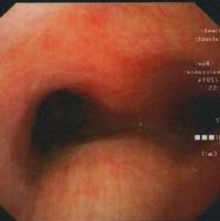 Morphology of the carinas