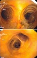 Yellow mucosa: jaundice