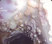 Mucosal vesicles