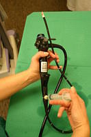 Echo bronchoscope