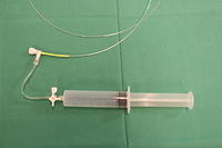 Transbronchial needle (WANG)