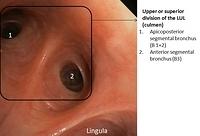 Upper division of the LUL (culmen) - annotations