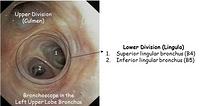 Left upper lobe bronchus - annotations