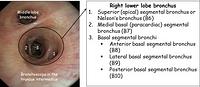 Right lower lobe brochus- annotations