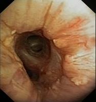 Case 3: month 6