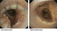 Case 4: month 10