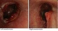 Case 2: day 20 and month 3